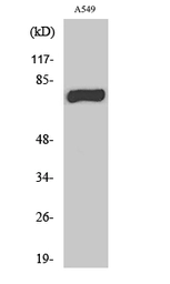 Anti-MPHOSPH9 antibody used in Western Blot (WB). GTX34083