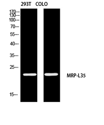 Anti-MRPL35 antibody used in Western Blot (WB). GTX34086