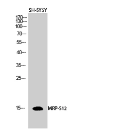 Anti-MRPS12 antibody used in Western Blot (WB). GTX34089