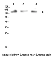 Anti-EXPAND1 / MUM1 antibody used in Western Blot (WB). GTX34091