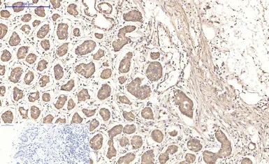 Anti-IKB beta antibody [1F3] used in IHC (Paraffin sections) (IHC-P). GTX34098