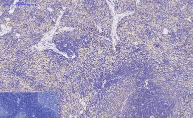 Anti-IKB beta antibody [1F3] used in IHC (Paraffin sections) (IHC-P). GTX34098
