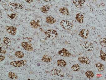 Anti-IKB beta antibody [1F3] used in IHC (Paraffin sections) (IHC-P). GTX34098