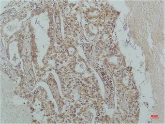 Anti-IKB beta antibody [1F3] used in IHC (Paraffin sections) (IHC-P). GTX34098