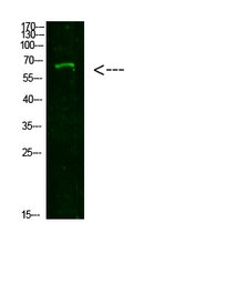 Anti-NUT antibody used in Western Blot (WB). GTX34106