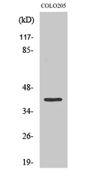 Anti-OR10D4 antibody used in Western Blot (WB). GTX34108