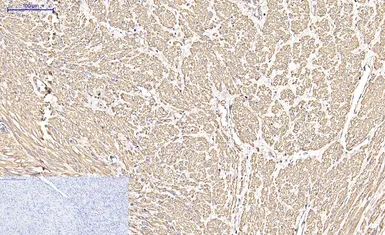 Anti-alpha Smooth Muscle Actin antibody [6A12] used in IHC (Paraffin sections) (IHC-P). GTX34111