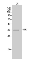 Anti-OSR2 antibody used in Western Blot (WB). GTX34114
