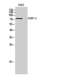 Anti-PARP2 antibody used in Western Blot (WB). GTX34116