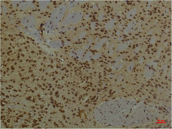 Anti-PI3 kinase p85 alpha antibody [3B7] used in IHC (Paraffin sections) (IHC-P). GTX34122