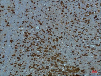 Anti-PI3 kinase p85 alpha antibody [2D2] used in IHC (Paraffin sections) (IHC-P). GTX34123