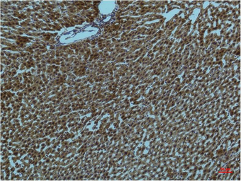 Anti-PI3 kinase p85 alpha antibody [2D2] used in IHC (Paraffin sections) (IHC-P). GTX34123