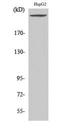Anti-PIKfyve antibody used in Western Blot (WB). GTX34124