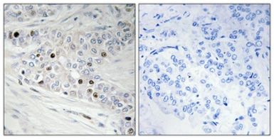 Anti-PKNOX2 antibody used in IHC (Paraffin sections) (IHC-P). GTX34125