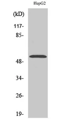Anti-PKNOX2 antibody used in Western Blot (WB). GTX34125