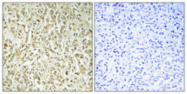 Anti-DNA polymerase lambda antibody used in IHC (Paraffin sections) (IHC-P). GTX34129