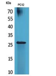 Anti-POLR3G antibody used in Western Blot (WB). GTX34131