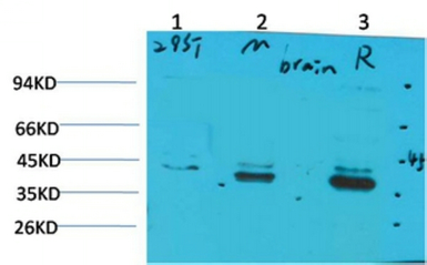 Anti-CABP2 antibody used in Western Blot (WB). GTX34132