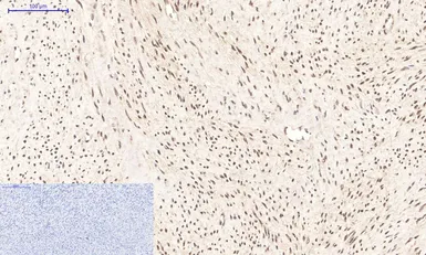 Anti-PPAR delta antibody [2F9] used in IHC (Paraffin sections) (IHC-P). GTX34133