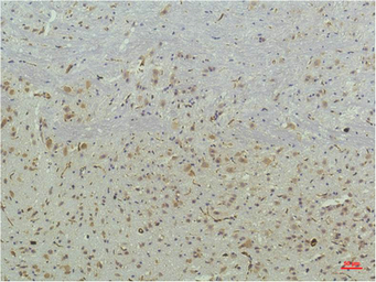 Anti-PPAR delta antibody [2F9] used in IHC (Paraffin sections) (IHC-P). GTX34133