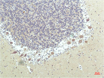 Anti-PPAR delta antibody [1D7] used in IHC (Paraffin sections) (IHC-P). GTX34134