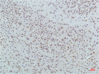 Anti-PPAR delta antibody [1D7] used in IHC (Paraffin sections) (IHC-P). GTX34134