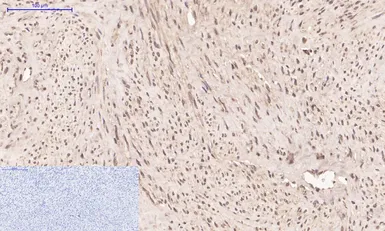 Anti-Cyclophilin B antibody [2B10] used in IHC (Paraffin sections) (IHC-P). GTX34135
