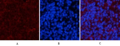 Anti-Cyclophilin B antibody [2B10] used in Immunohistochemistry (IHC). GTX34135