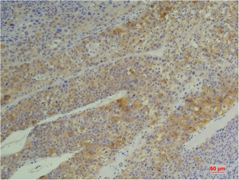 Anti-Cyclophilin B antibody [1B3] used in IHC (Paraffin sections) (IHC-P). GTX34136