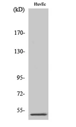 Anti-PPP2R3C antibody used in Western Blot (WB). GTX34137