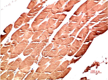 Anti-AMPK alpha 1 antibody [9G3] used in IHC (Paraffin sections) (IHC-P). GTX34142
