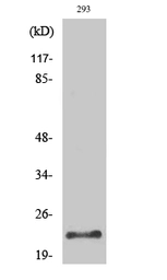 Anti-PRSS1 antibody used in Western Blot (WB). GTX34147