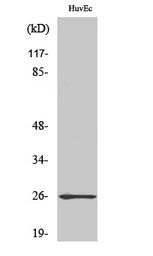 Anti-RABL2A antibody used in Western Blot (WB). GTX34154