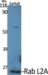 Anti-RABL2A antibody used in Western Blot (WB). GTX34154
