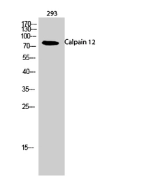 Anti-Calpain 12 antibody used in Western Blot (WB). GTX34157
