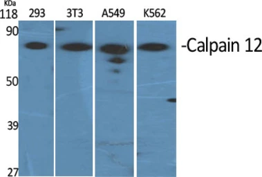 Anti-Calpain 12 antibody used in Western Blot (WB). GTX34157