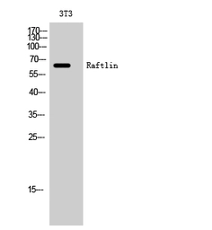 Anti-RFTN1 antibody used in Western Blot (WB). GTX34158