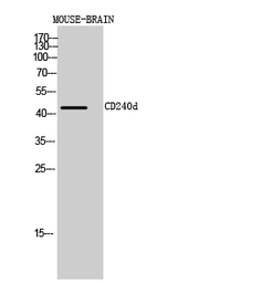 Anti-RhD antibody used in Western Blot (WB). GTX34162