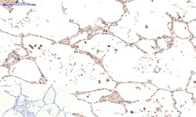 Anti-Caspase 3 antibody [5E1] used in IHC (Paraffin sections) (IHC-P). GTX34164
