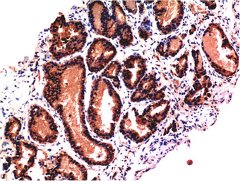 Anti-Caspase 3 antibody [5H10] used in IHC (Paraffin sections) (IHC-P). GTX34166