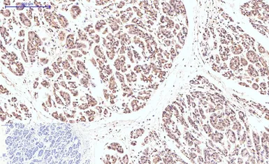 Anti-Caspase 8 antibody [2G12] used in IHC (Paraffin sections) (IHC-P). GTX34167