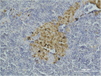 Anti-Caspase 8 antibody [2G12] used in IHC (Paraffin sections) (IHC-P). GTX34167