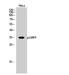 Anti-RNF144B antibody used in Western Blot (WB). GTX34170