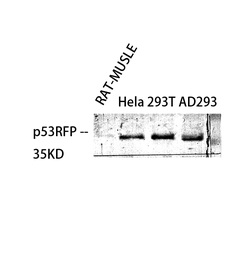 Anti-RNF144B antibody used in Western Blot (WB). GTX34170
