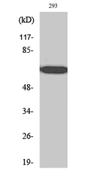 Anti-RPAP2 antibody used in Western Blot (WB). GTX34172