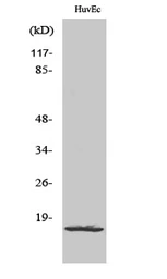 Anti-RPL26L1 antibody used in Western Blot (WB). GTX34173