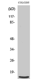 Anti-RPL39 antibody used in Western Blot (WB). GTX34176