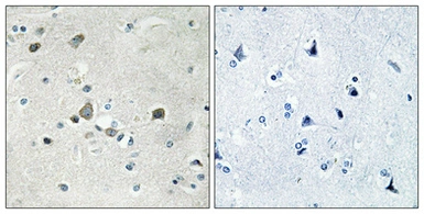 Anti-RPS4Y1 antibody used in IHC (Paraffin sections) (IHC-P). GTX34177