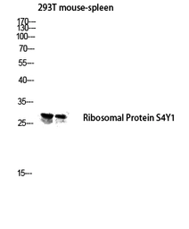 Anti-RPS4Y1 antibody used in Western Blot (WB). GTX34177