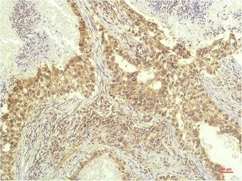 Anti-p70 S6K antibody [1C7] used in IHC (Paraffin sections) (IHC-P). GTX34178